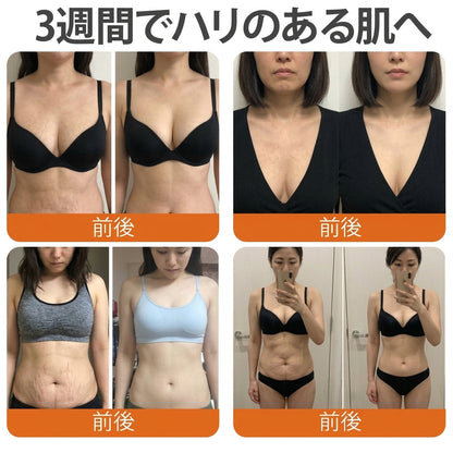 🧑‍⚕️PuraCure® ビーベノム リペア再生クリーム🔥天然由来のエイジングケアで肌を引き締め、ハリを与え、乾燥による小ジワを目立たなくします – 50mL